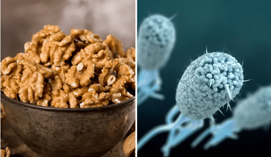 E. coli Linked to the Organic Walnuts: What You Need to Know